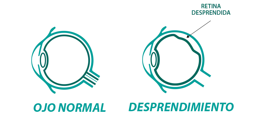 info1-retina