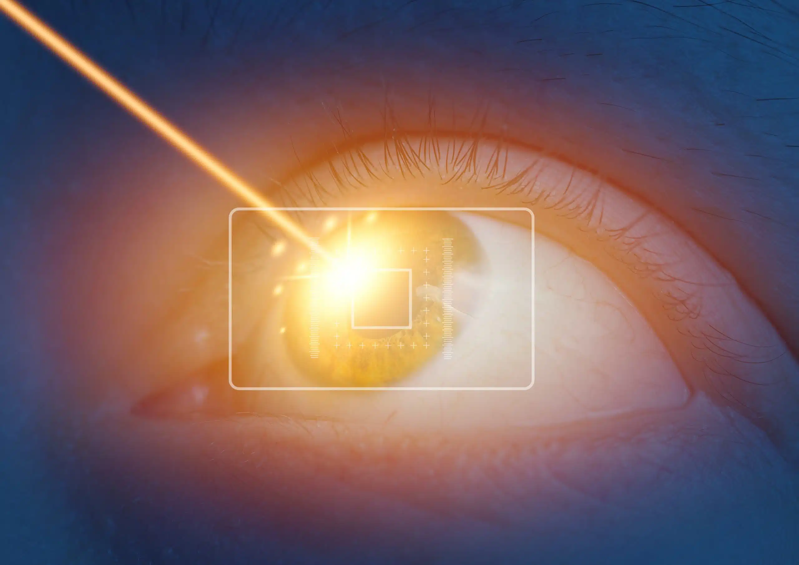 Laser,Eye,Surgery,Or,Lasik,Concept,,Close,Up,Of,Female